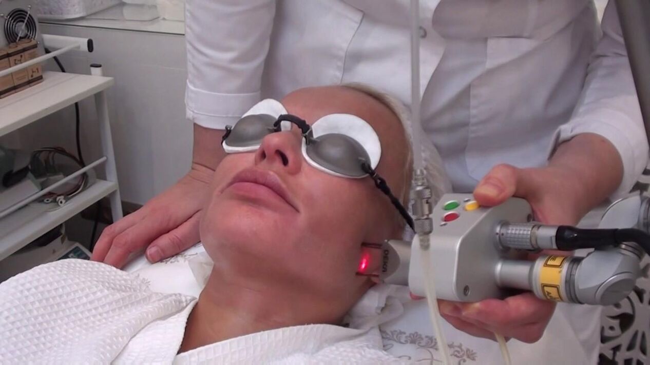 Traitement par faisceau laser des zones à problèmes de la peau du visage